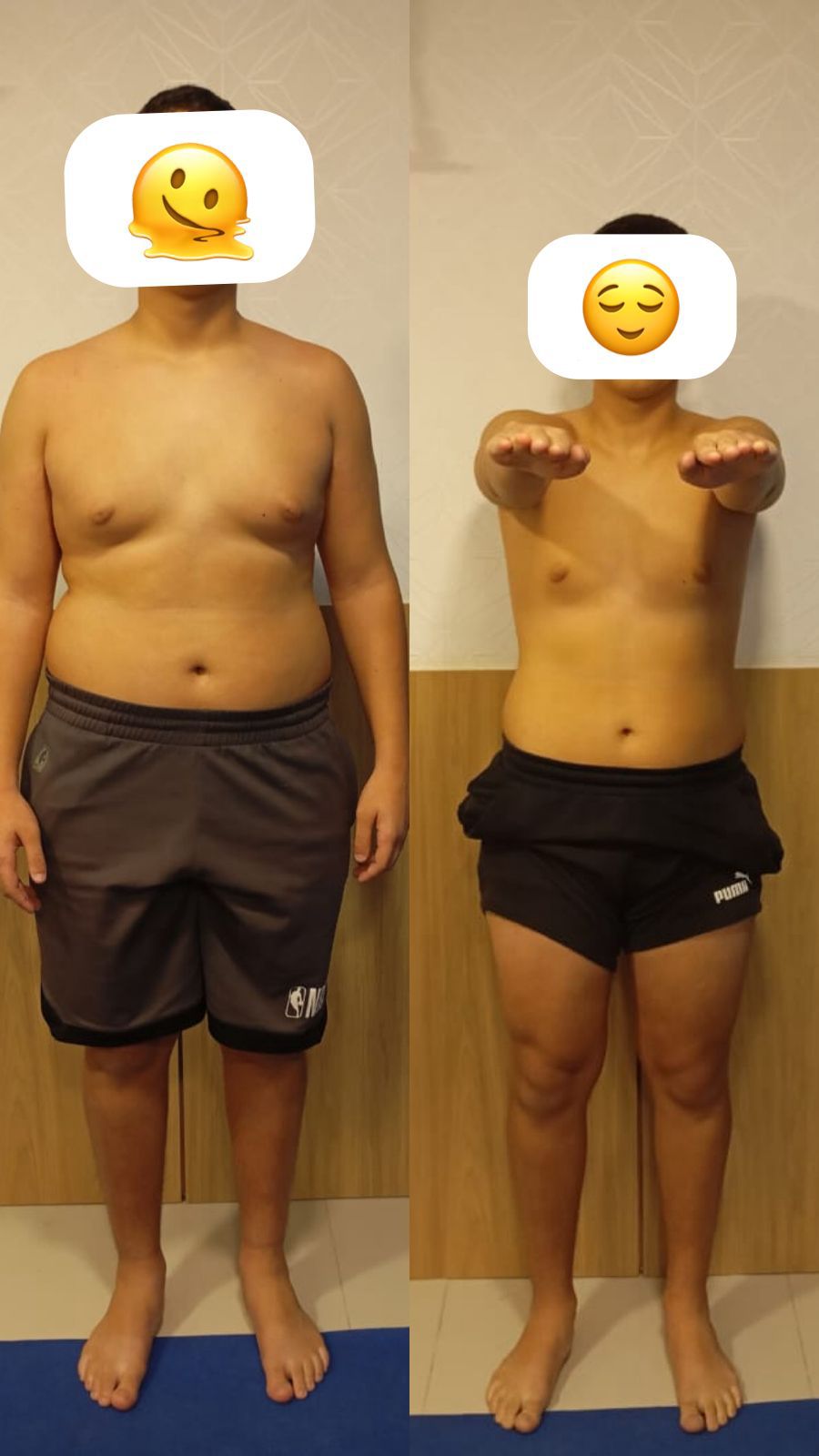 Comparativo antes e depois